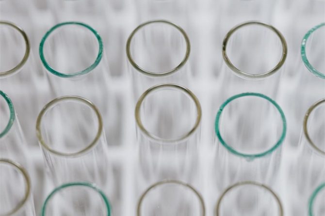 Provođenje antigenskih i seroloških testova u Domu zdravlja PGŽ